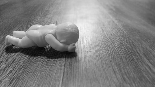 Депутаты Узбекистана потребовали от Минздрава отчитаться о смертях в частных клиниках