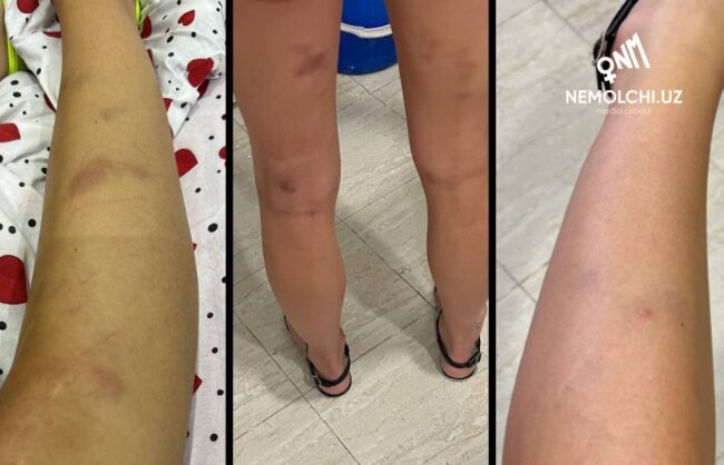 Гражданка России подверглась сексуальному насилию в Самарканде