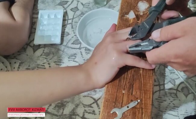 В Нукусе на пальце девочки застряло кольцо, спасатели пришли на помощь