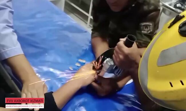 В Андижане спасателям пришлось снимать кольцо с пальца девочки