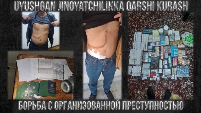 На территории Узбекистана обезврежена преступная группа, связанная с незаконной пересадкой человеческих органов