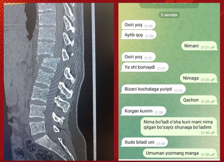 В Навои мужчина за рулём автомобиля переехал свою бывшую жену и сломал ей позвоночник