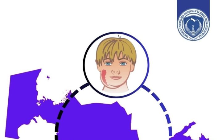 В Санэпидемкомитете Узбекистана рассказали об особенностях краснухи