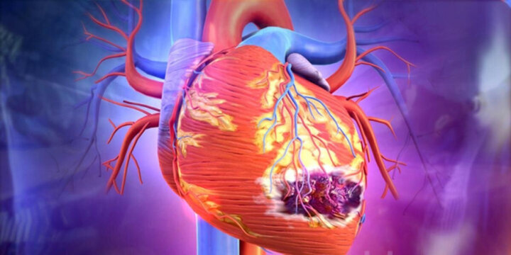 С 1 мая в Узбекистане внедрят программу борьбы с инфарктом